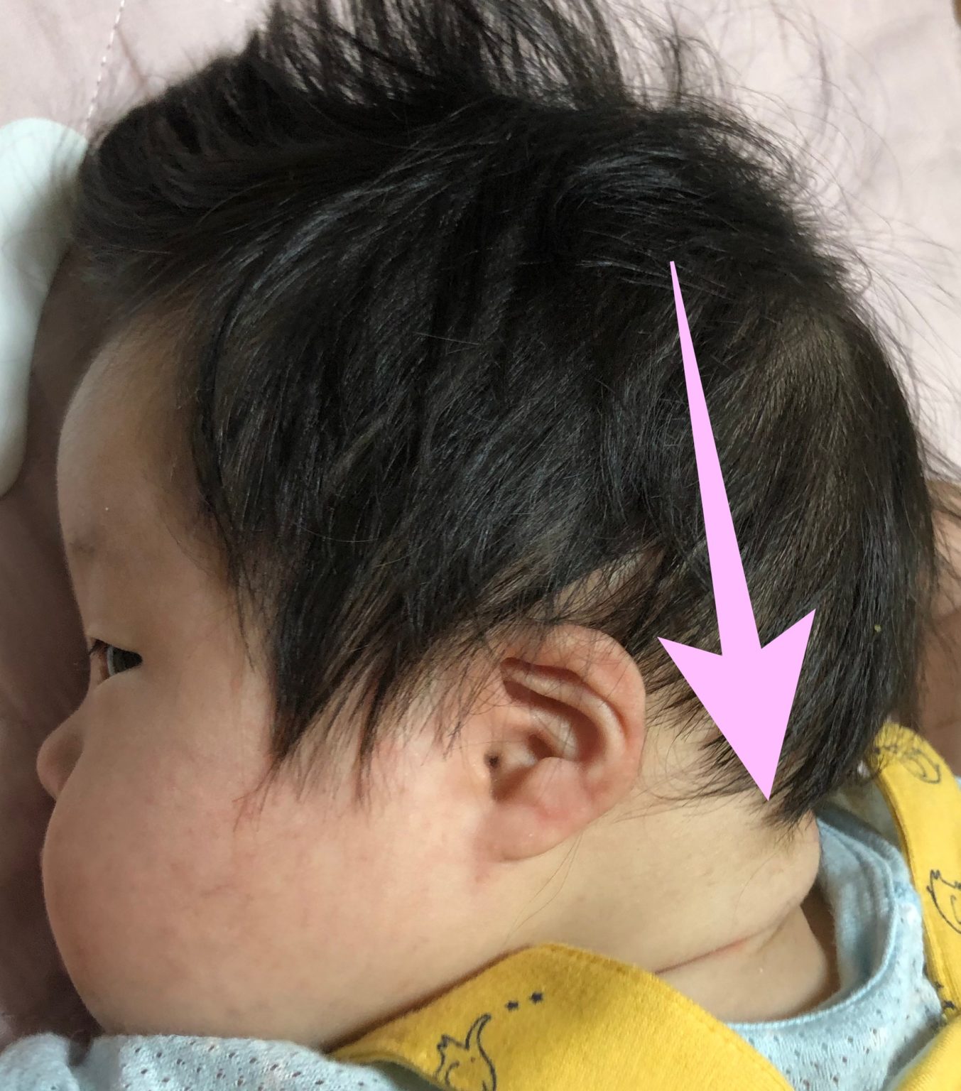 ダウン症の赤ちゃん、その特徴 〜おーくんの場合〜｜うこうこまーく！